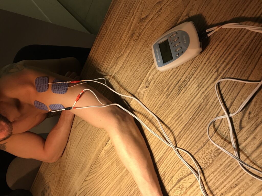 Behandling af synkebesvær med el-stimulation (VitalStim)