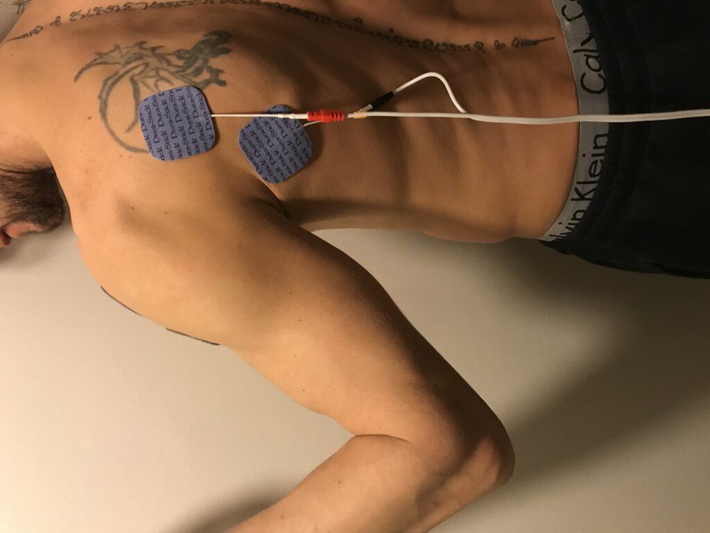 Behandling af synkebesvær med el-stimulation (VitalStim)